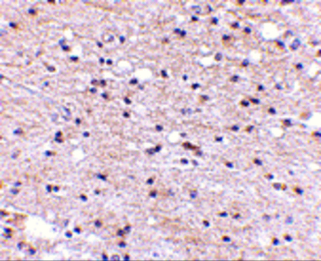 AMBRA1 Antibody in Immunohistochemistry (IHC)