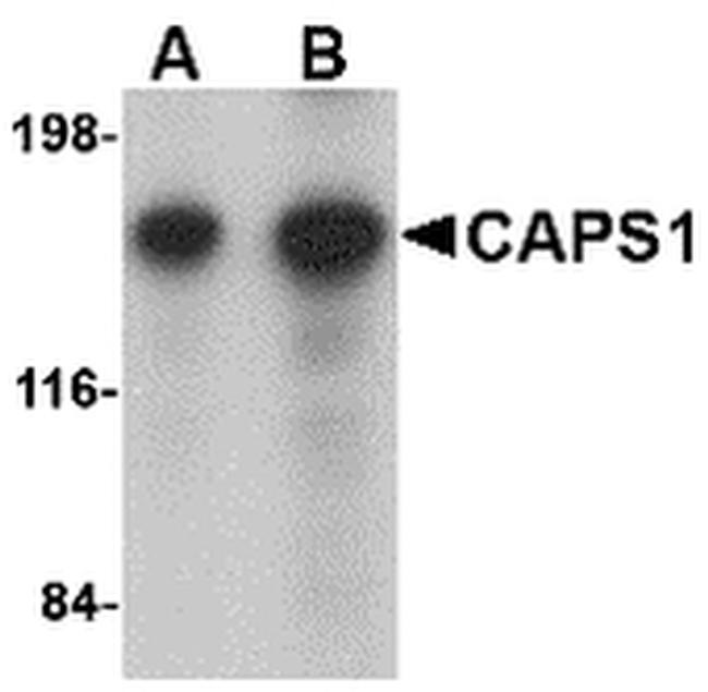 CAPS1 Antibody in Western Blot (WB)