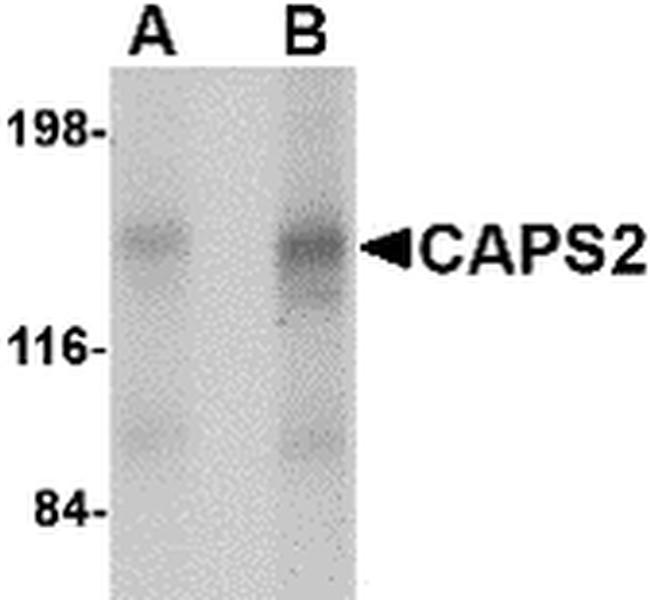 CADPS2 Antibody in Western Blot (WB)