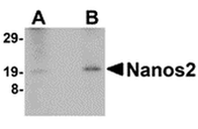 NANOS2 Antibody in Western Blot (WB)