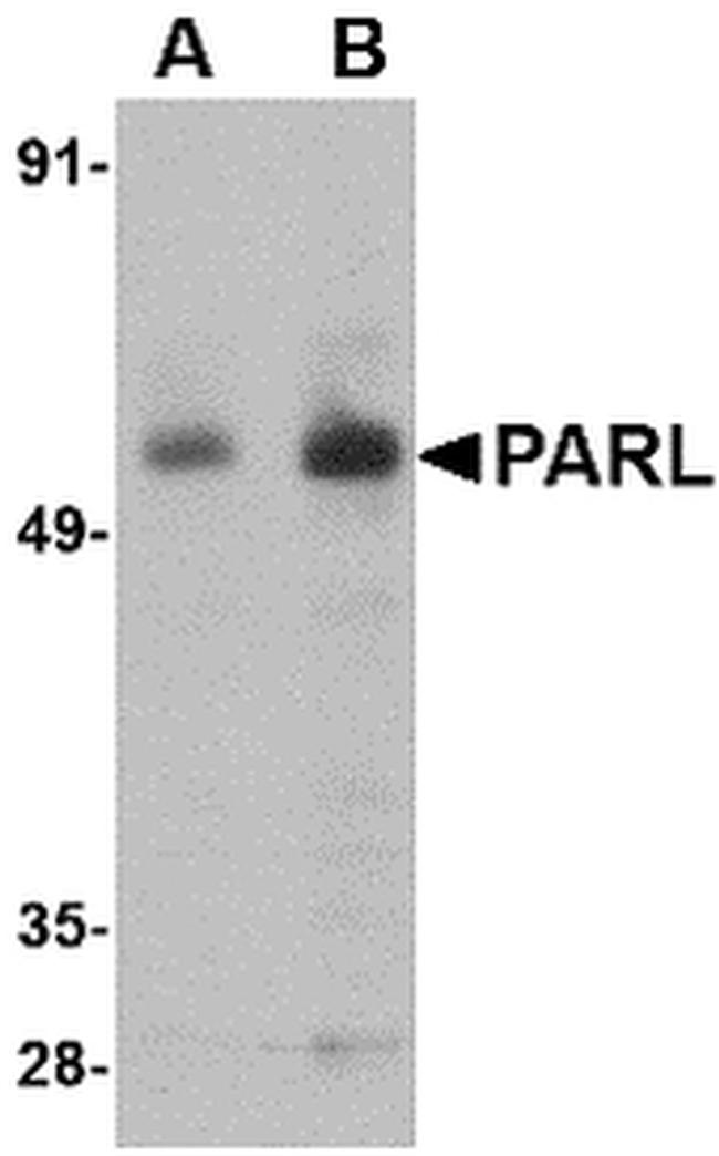 PARL Antibody in Western Blot (WB)