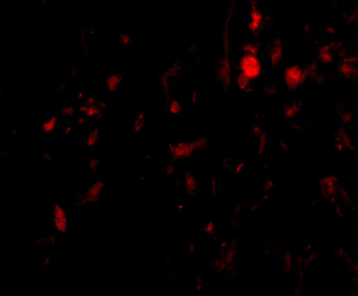 Calpain 6 Antibody in Immunocytochemistry (ICC/IF)