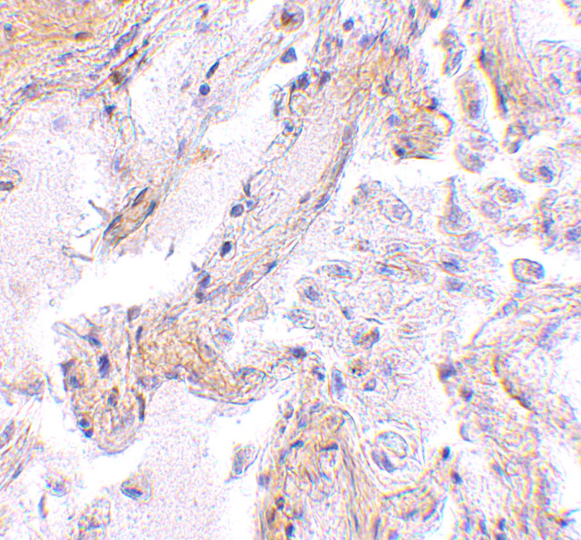 Calpain 6 Antibody in Immunohistochemistry (IHC)