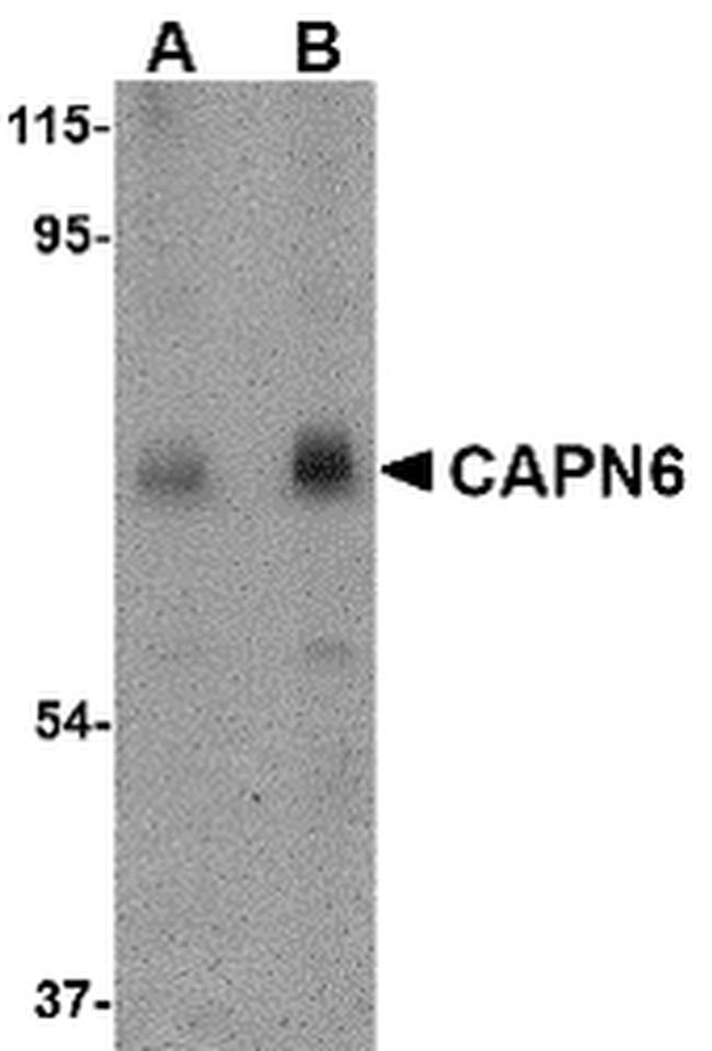 Calpain 6 Antibody in Western Blot (WB)