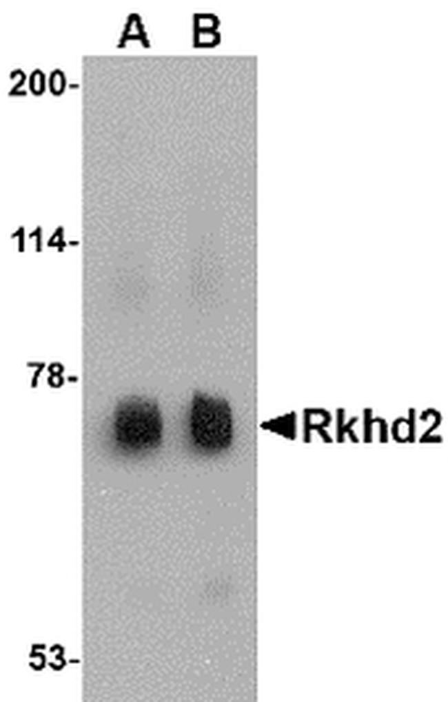 RKHD2 Antibody in Western Blot (WB)