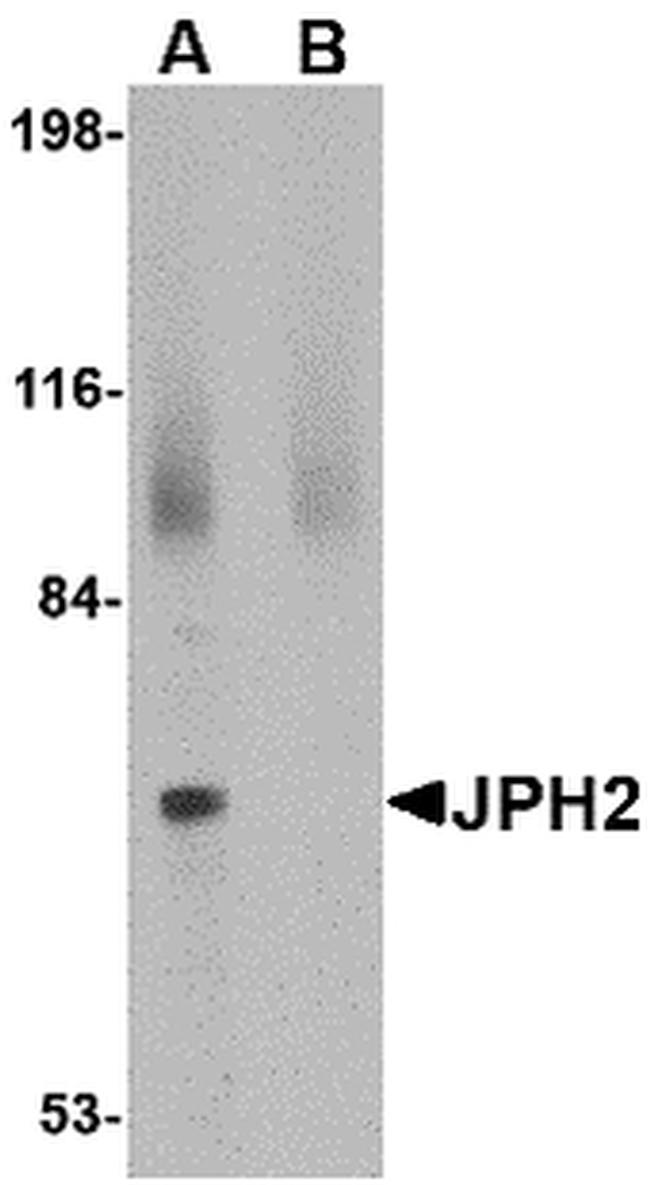 JPH2 Antibody in Western Blot (WB)