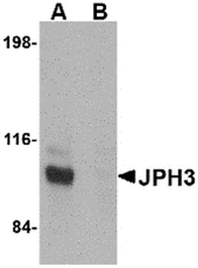 JPH3 Antibody in Western Blot (WB)