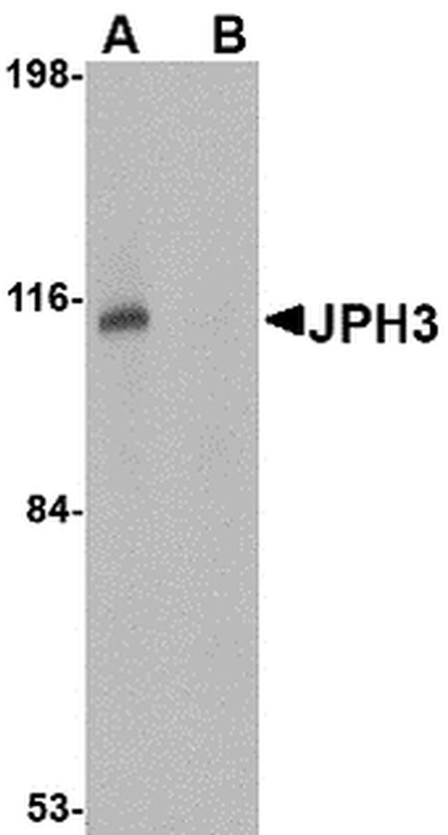 JPH3 Antibody in Western Blot (WB)