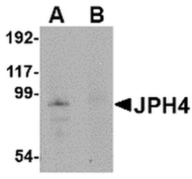 JPH4 Antibody in Western Blot (WB)