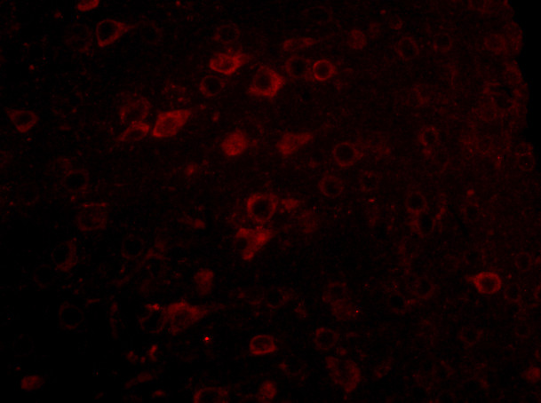 Lass6 Antibody in Immunocytochemistry (ICC/IF)