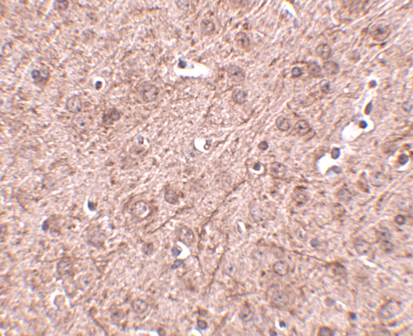 Lass6 Antibody in Immunohistochemistry (IHC)