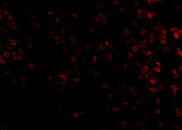 KLRA1 Antibody in Immunocytochemistry (ICC/IF)