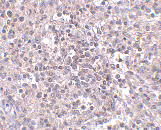 ZIP10 Antibody in Immunohistochemistry (IHC)