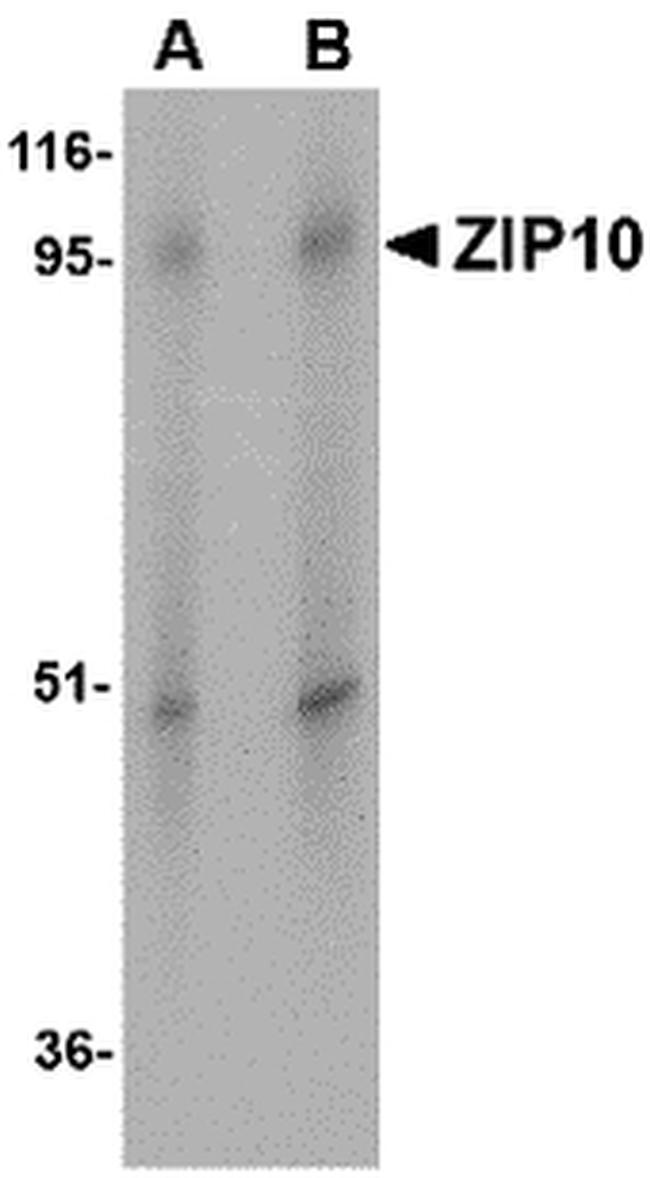 ZIP10 Antibody in Western Blot (WB)