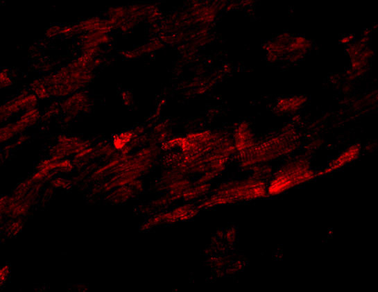 ZFYVE26 Antibody in Immunohistochemistry (IHC)