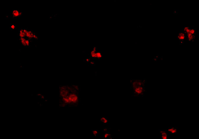 KCTD15 Antibody in Immunohistochemistry (IHC)