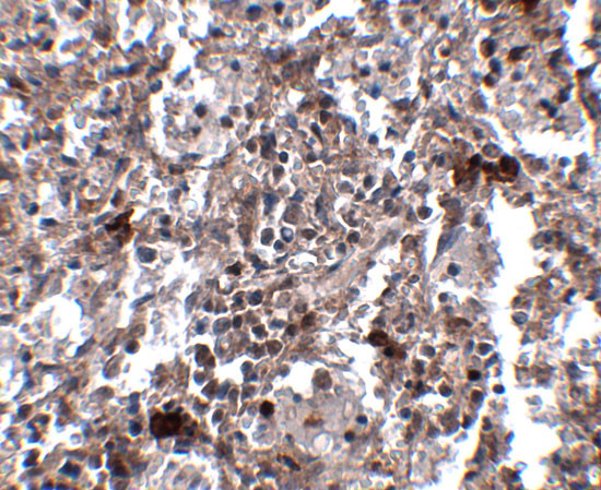 KCTD15 Antibody in Immunohistochemistry (IHC)