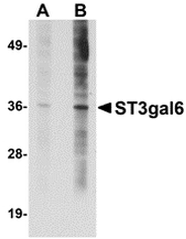 ST3GAL6 Antibody in Western Blot (WB)