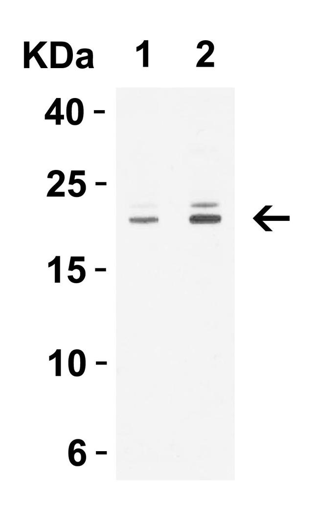 Claudin 1 Antibody in Western Blot (WB)