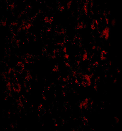 MACC1 Antibody in Immunocytochemistry (ICC/IF)