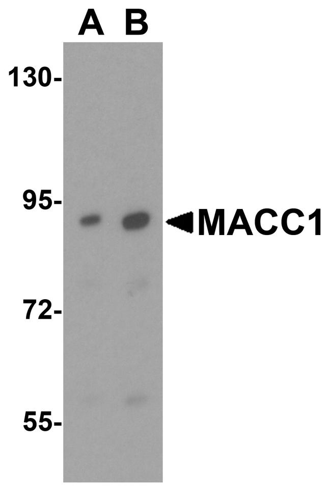 MACC1 Antibody in Western Blot (WB)