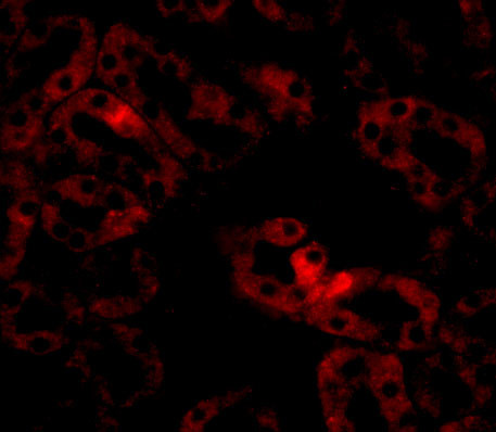 LIAR Antibody in Immunocytochemistry (ICC/IF)