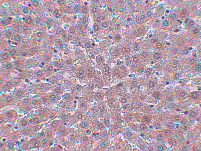 JMJD1B Antibody in Immunohistochemistry (IHC)