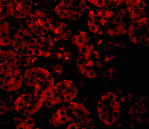 JMJD8 Antibody in Immunocytochemistry (ICC/IF)