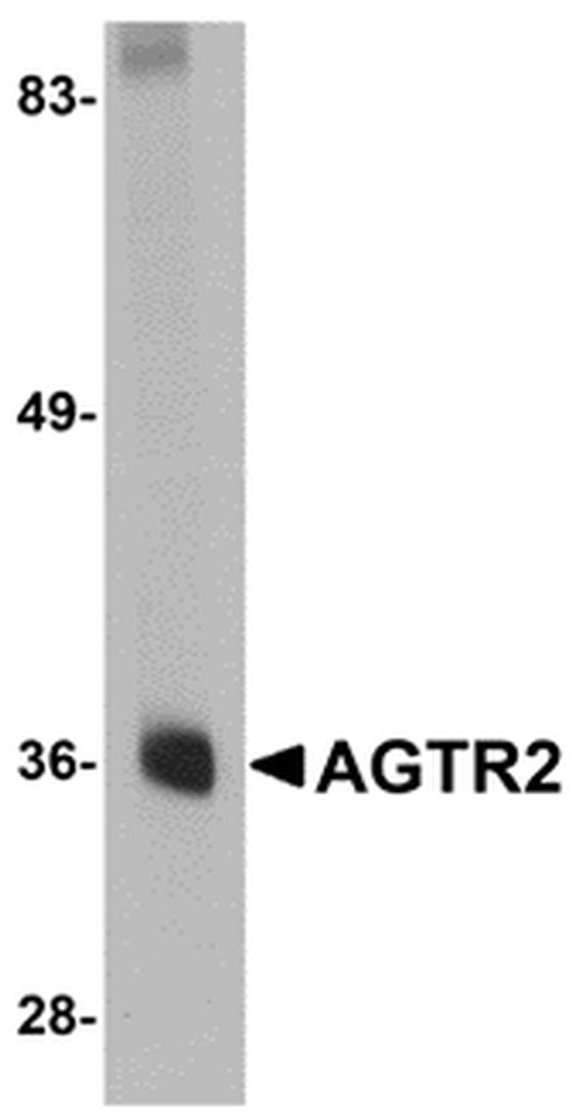 AGTR2 Antibody in Western Blot (WB)