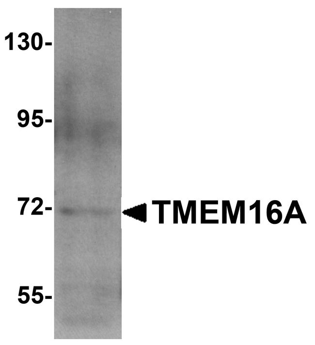 DOG-1 Antibody in Western Blot (WB)