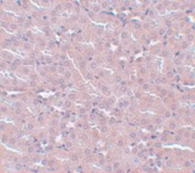 FRMPD2 Antibody in Immunohistochemistry (IHC)