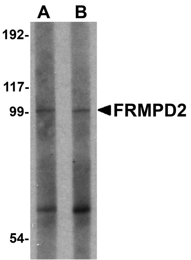 FRMPD2 Antibody in Western Blot (WB)