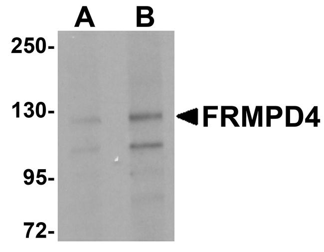 FRMPD4 Antibody in Western Blot (WB)