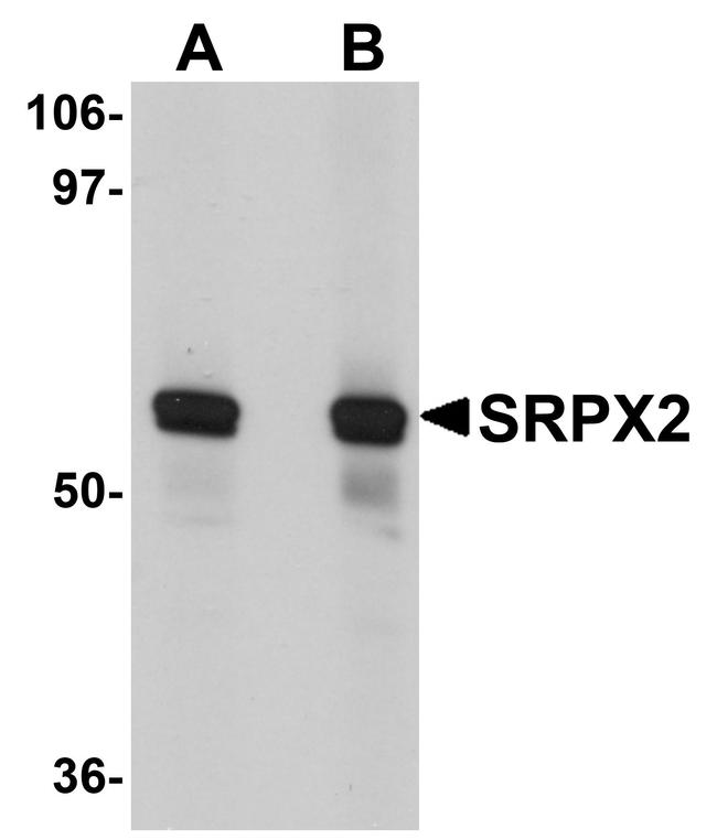 SRPX2 Antibody in Western Blot (WB)