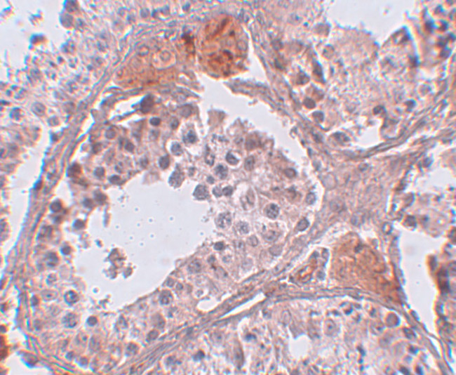 CLPH Antibody in Immunohistochemistry (IHC)