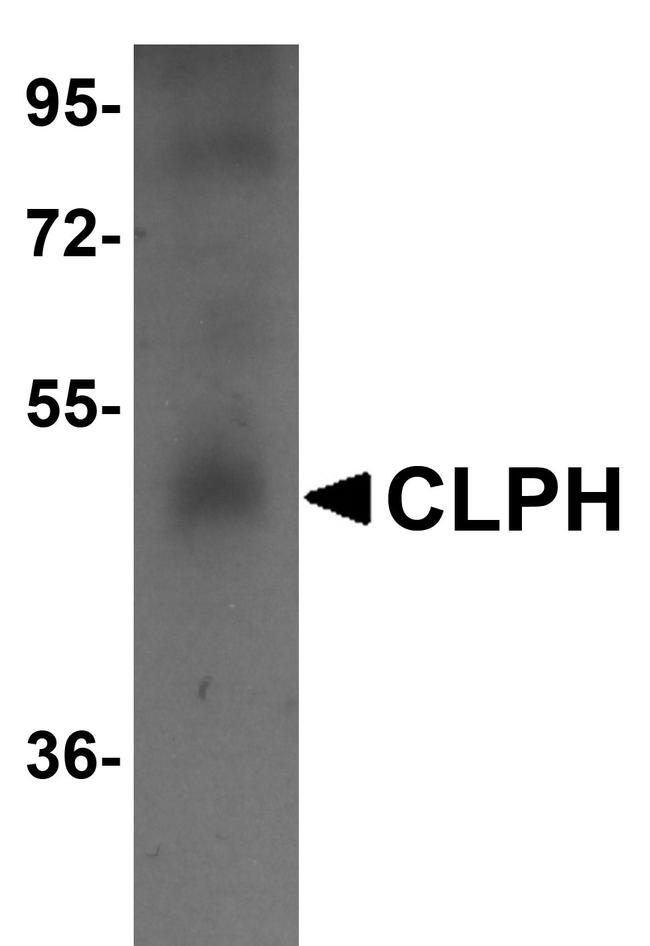 CLPH Antibody in Western Blot (WB)