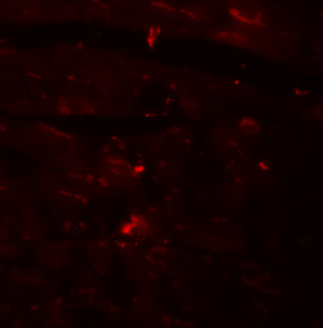 CCDC47 Antibody in Immunohistochemistry (IHC)