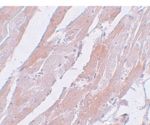 CCDC47 Antibody in Immunohistochemistry (IHC)