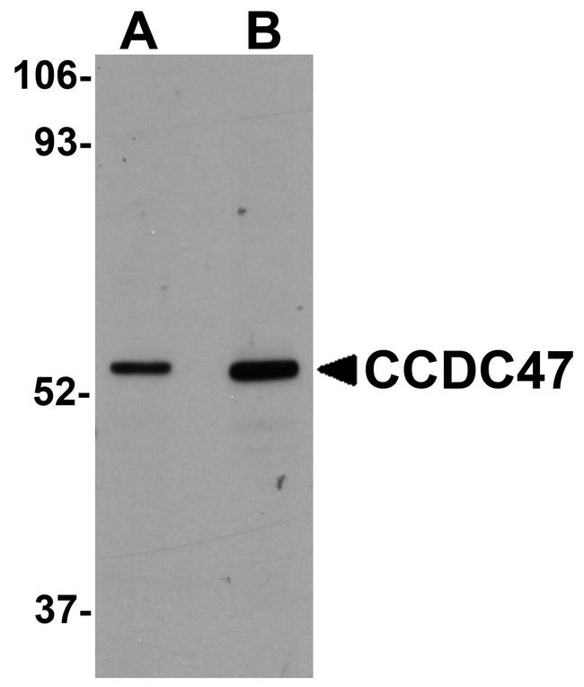 CCDC47 Antibody in Western Blot (WB)