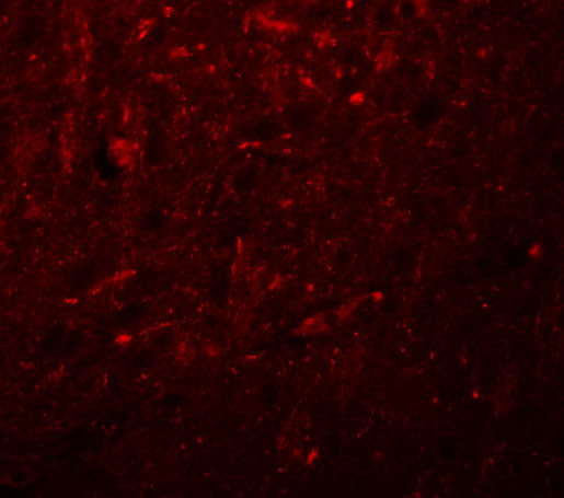 KCNK18 Antibody in Immunocytochemistry (ICC/IF)