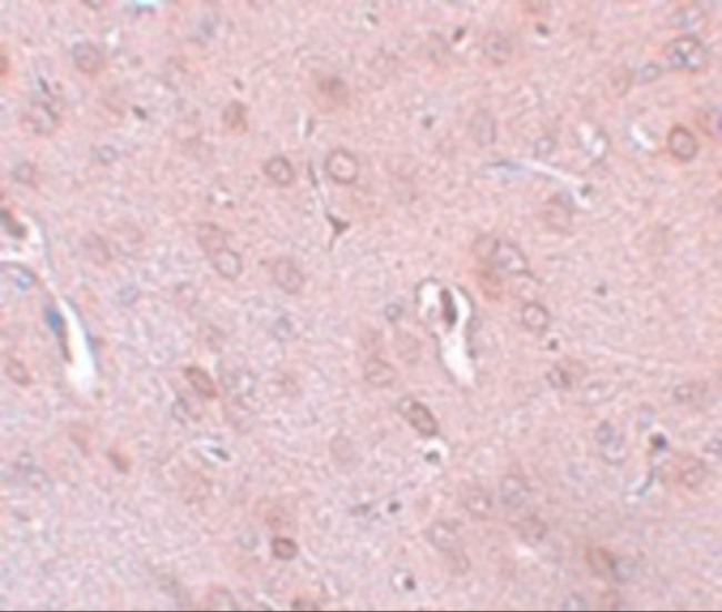 KCNK18 Antibody in Immunohistochemistry (IHC)