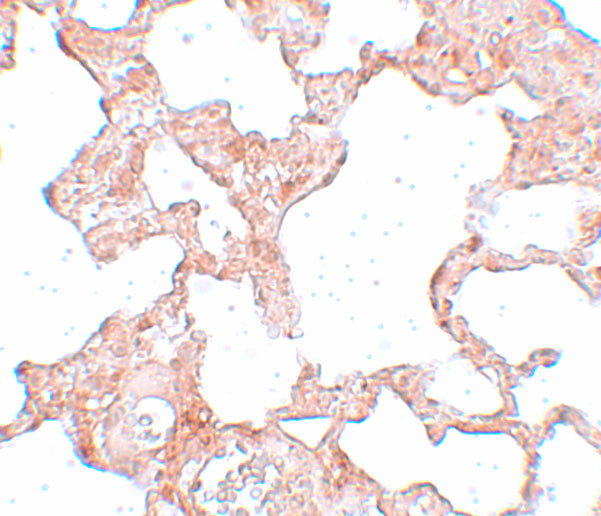 VLK Antibody in Immunohistochemistry (IHC)