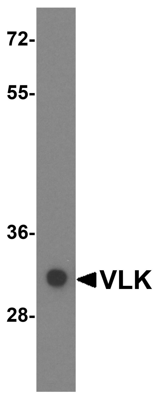 VLK Antibody in Western Blot (WB)