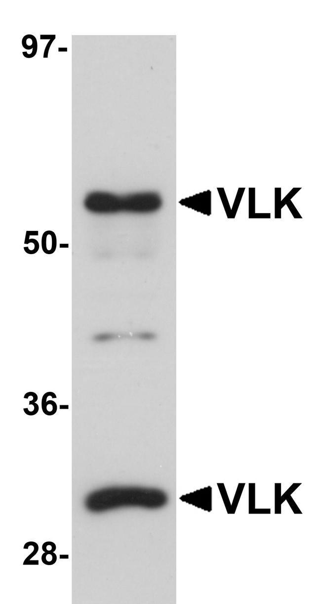 VLK Antibody in Western Blot (WB)