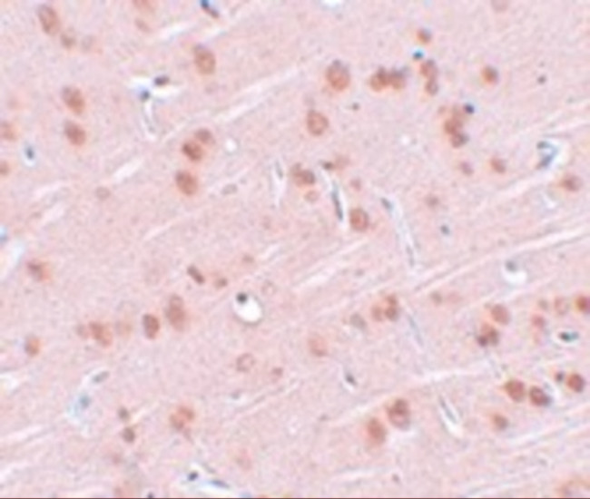 SYNGR1 Antibody in Immunohistochemistry (IHC)