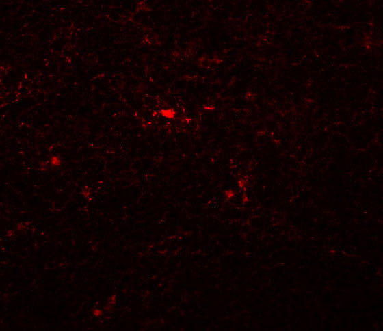 NAT11 Antibody in Immunohistochemistry (IHC)