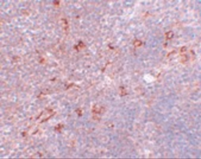 NAT11 Antibody in Immunohistochemistry (IHC)