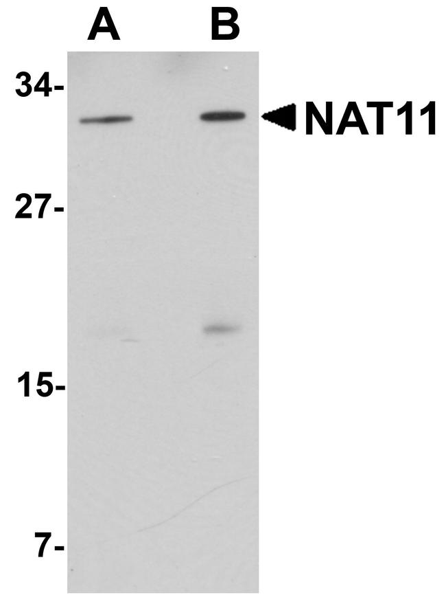 NAT11 Antibody in Western Blot (WB)