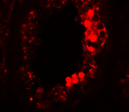 ESX1 Antibody in Immunohistochemistry (IHC)