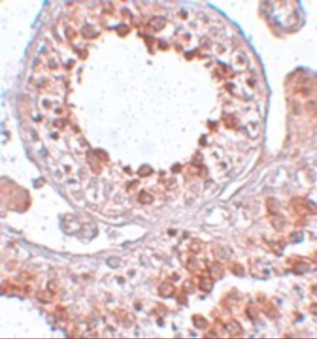 ESX1 Antibody in Immunohistochemistry (IHC)